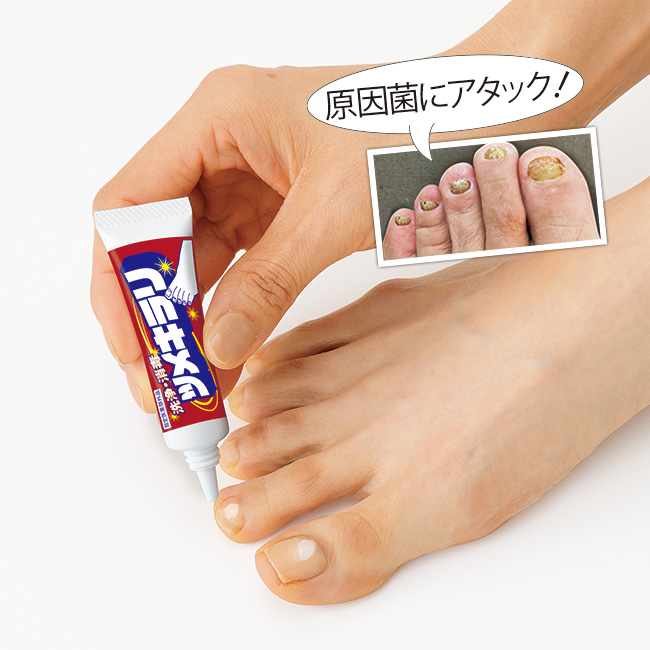 薬用ツメキラリ／3個組