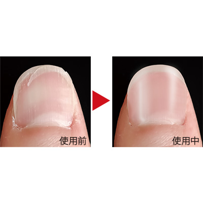 美爪ストロング／3個セット