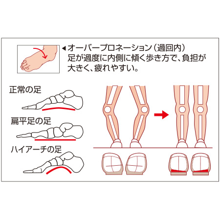 アーチウェッジヒールサポーター薄型 2足セット