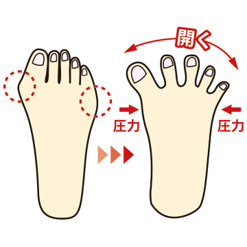 足指を広げるインナーサポーター／2組セット