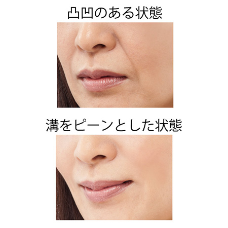 ミゾピーンポイント2本セット