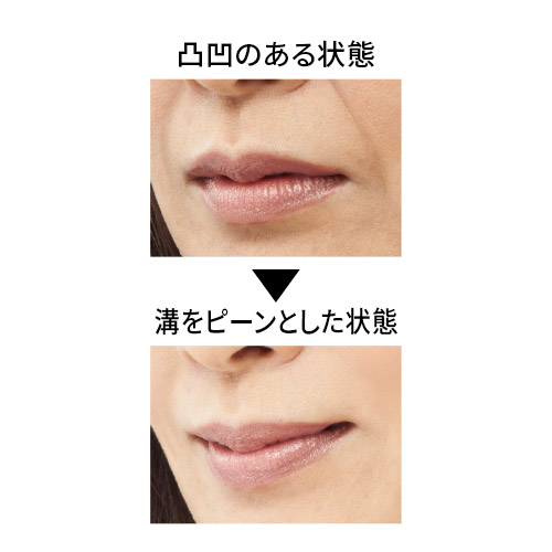 ミゾピーンポイント2本セット
